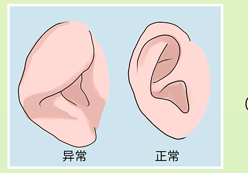 顾泽朝聚医院周羽耳朵畸形矫正技术怎么样?收费多少